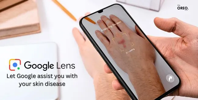 Identify skin condition with google lens