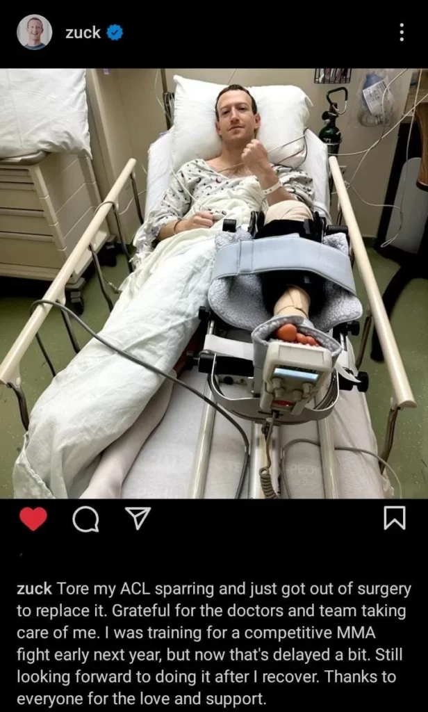 Mark zuckerberg underwent surgery for ACL